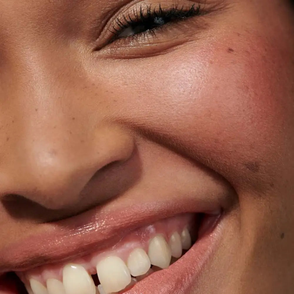 A bright, genuine smile showing white teeth.